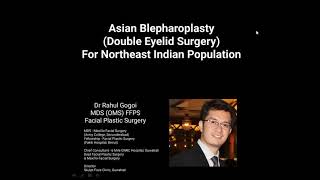 Asian Blepharoplasty - Double Eyelid Surgery, Guwahati. Dr Rahul Gogoi, Facial Plastic Surgery