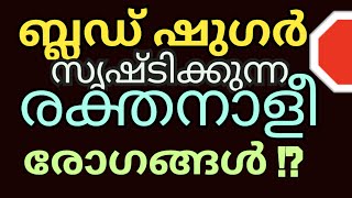 #bloodsugar ഷുഗർ മൂലം ഉണ്ടാവുന്ന വാസ്കുലർ ഡിസീസ്എന്താണെന്ന് അറിയുക !