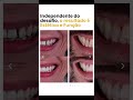 saúde função e estética esteticadental dentistas dentista dentist odontologo odontología