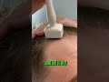 this is how i use my derma stamp to increase my hair growth