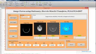 MATLAB code of Medical Image Fusion in Dicom format