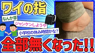 【2ch 面白いスレ 伝説】【バカ】見て！ワイの指全部無くなった！！→小学校の休み時間かよｗｗｗｗ【2ch 笑える ゆっくり解説 】