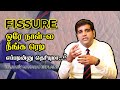 Anal fissure - Causes, symptoms & treatment in Tamil | Dr.Rajiv Maharaj | GEM Hospitals