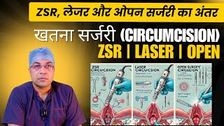 खतना सर्जरी (Circumcision): ZSR, लेजर और ओपन सर्जरी का अंतर और यह कैसे की जाती है ?