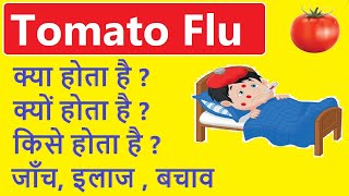 Tomato flu information in hindi || टोमेटो फ्लू के लक्षण || टोमेटो फ्लू के कारण ||