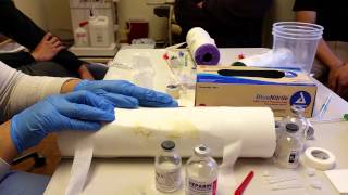 GRAFT CANNULATION