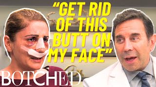 Dr. Nassif Attempts To Fix Rose's 'Butt Nose' After Two Failed Surgeries | Botched | E!