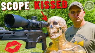 SCOPE KISSES 💋 (How Dangerous Are They ???)