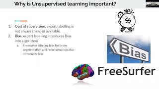 MLBBQ:  Unsupervised Deep Learning for Bayesian Brain MRI Segmentation  by William Ashbee