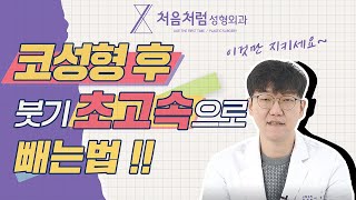 👃🏻코수술  후 붓기 초고속으로 빼는 법❗