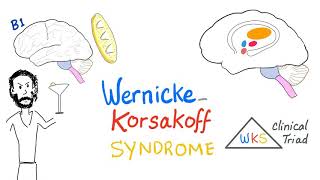 Wernicke-Korsakoff Syndrome (WKS) | Biochemistry