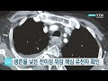 생존율 낮은 전이성 위암 핵심 유전자 확인 ytn 사이언스