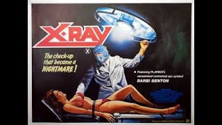 Review - 207 - X-Ray aka Hospital Massacre - 1981