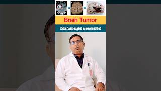 ഉറങ്ങി എണീക്കുമ്പോൾ തല വേദന ? Simple tips to identify types of headache #braintumour  #healthtips