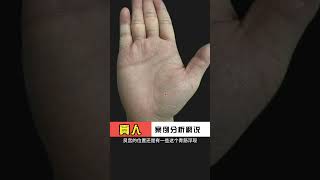 🔥幫粉絲看手相 🤚☯看看是不是跟你一樣的手紋，#palmistry  #手相