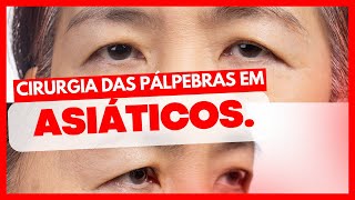 ATENÇÃO: A CIRURGIA das PÁLPEBRAS é DIFERENTE para ASIÁTICOS? VEJA AGORA!