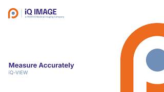 Polygon ROI Measurement Guide for Radiology | iQ-VIEW