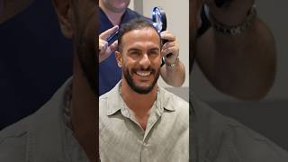 Nininho Vaz Maia Portuguese Musician Cosmedica Clinic Hair Transplant #video #hairtransplant #shorts