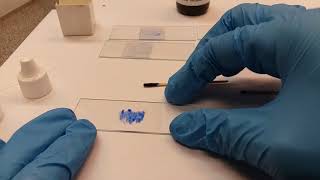How to Dye Cheek Cells *Standard Method