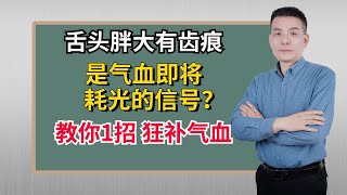 舌头胖大有齿痕，是气血即将耗光的信号？教你1招，狂补气血！