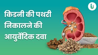 किडनी की पथरी निकालने में असरदार है ये आयुर्वेदिक दवा | Ayurvedic Medicine for Kidney Stone Hindi