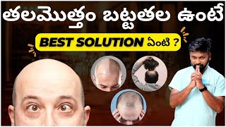 #AskDrJohnWatts | తలమొత్తం బట్టతల ఉంటే BEST SOLUTION ఏంటి ? | Hair Specialist Explains