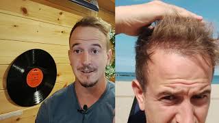 The truth about Dr Cinik clinic | 1 year review after hair transplant | Cheap hair transplant turkey