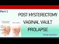 Post Hysterectomy Vault Prolapse, RCOG Guideline (Part 1)