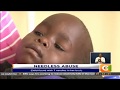 Child found with 7 needles in her body