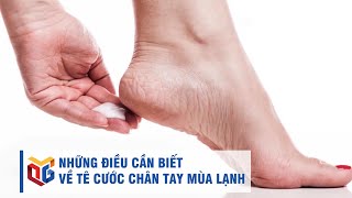 Những điều cần biết về tê cước chân tay mùa lạnh