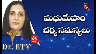 మధుమేహం - చర్మ సమస్యలు | డాక్టర్ ఈటీవీ  | 23rd ఆగస్టు 2021| ఈటీవీ  లైఫ్