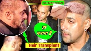 side effects of hair transplant| চুল প্রতি স্থাপনের পর ক্ষতিকর দিক কি?#health#hair #haircare