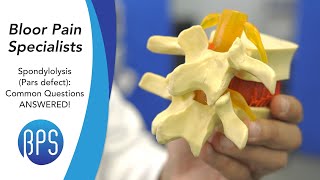 Everything You Wanted to Know About Spondylolysis (Pars Defect) - Compilation