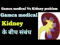 Kidney stones problem Vs Gamca medical checkup / के बीच संबंध