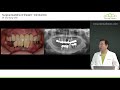 eng surgical guideline of implant introduction dr. cho yongseok