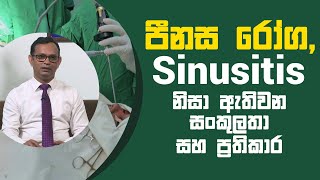 පීනස රෝග, Sinusitis නිසා ඇතිවන සංකුලතා සහ ප්‍රතිකාර | Piyum Vila | 08 - 04 - 2021 | SiyathaTV