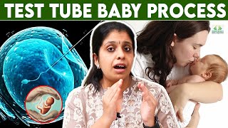 Test Tube Baby Treatment Tamil | Dr Deepthi Jammi,Cwc | IVF procedure , infertility, fertility