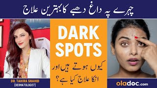 Chehre Ke Daag Dhabe Ka Ilaj - Dark Spots On Face Removal - Pigmentation Treatment - Spotless Skin