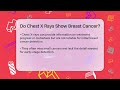 do chest x rays show breast cancer oncology support network