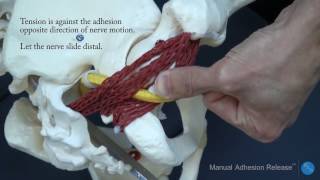 Integrative Diagnosis: Sciatic nerve adhesion diagnosis and treatment with Manual Adhesion Release®