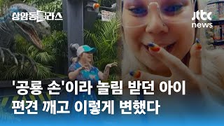 자신감으로 편견 부순다…'세 손가락'으로 태어난 여성의 충격 근황 / JTBC 상암동 클라스