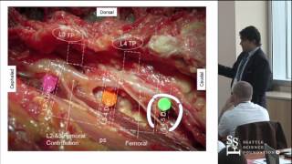 Difficult Lateral Spine Cases by Rod Oskouian, MD