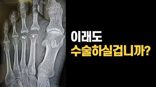 잘못된 수술로 인생을 망친 실제 케이스 3가지를 보여드립니다. 당신, 당신의 가족이 될 수 있습니다.