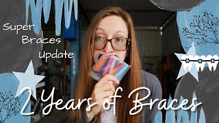 🦕Super Braces Update: 2 Years of Braces, 3 Orthodontists, Elastics, \u0026 a Few Other Things😘