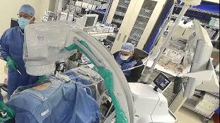 Core Videos (2022): Mini-Percutaneous Nephrolithotomy Using Endoscopic Combined Intrarenal Surgery