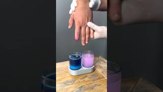 Making a Gold Prosthesis From Coins! 🤯