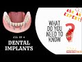 What are All-on-4® dental implants? - explained by Dr. Rogel Carlos