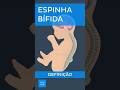 Espinha bífida: Definição | Kenhub #espinhabífida