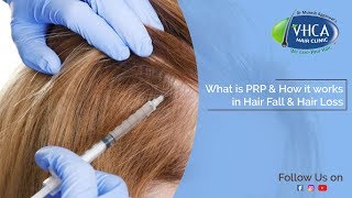 What is PRP and How it works in Hair Fall and Hair Loss