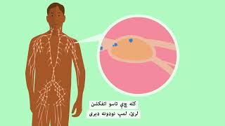 What is cancer? (Pashto) | سرطان څه ته وايي؟ (پښتو) | Macmillan Cancer Support